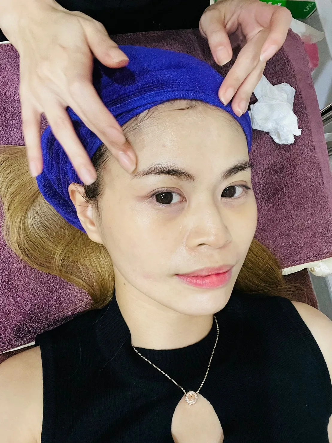 LINE_ALBUM_中山璀璨診所 4D皮秒PICOPLUS廖偉捷醫師神之手一次解決肌膚斑點毛孔問題 亞洲肌膚_1.jpg
