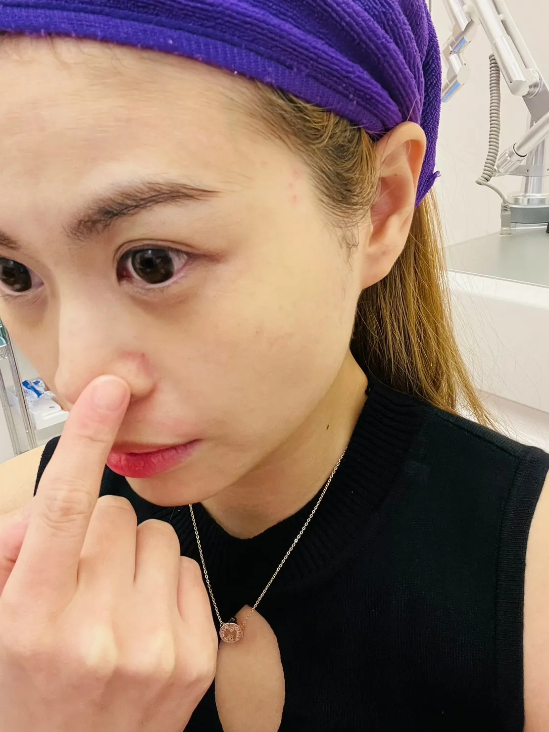 LINE_ALBUM_中山璀璨診所 4D皮秒PICOPLUS廖偉捷醫師神之手一次解決肌膚斑點毛孔問題 亞洲肌膚_4.jpg